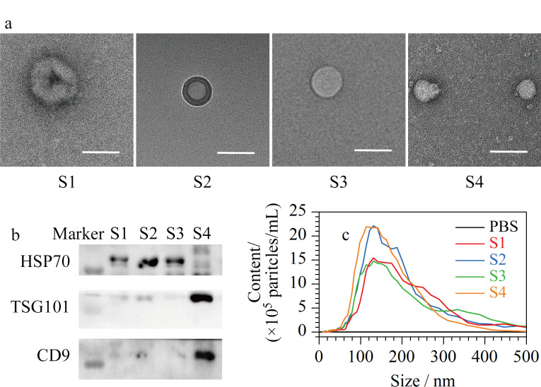 [Isolation and proteomics analysis of cerebrospinal fluid exosome subtypes].