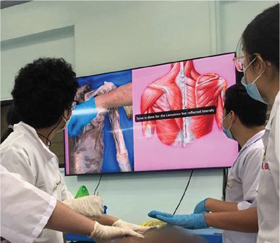 A Case Study on a Novel Teaching Method on Integumentary and Musculoskeletal Anatomy for First Year Medical Students in a National University in the Philippines (University of the Philippines College of Medicine) as a Potential Alternative to Traditional Cadaveric Dissection.