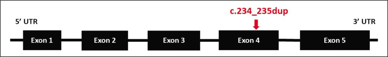 Bilateral Pheochromocytoma with a Novel Pathogenic Variant in the MAX gene: A Case Report.