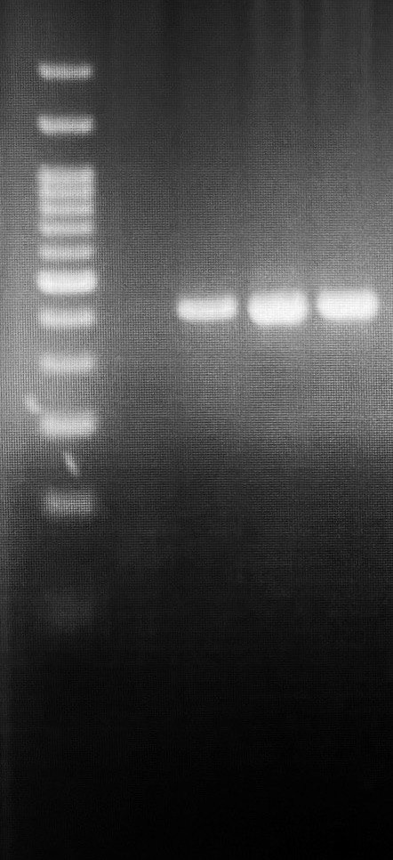 Identifying zoonotic risks: molecular insights into Cryptosporidium and Enterocytozoon bieneusi in pediatric cancer patients in Ahvaz, 2024.