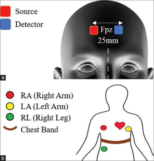 Enhanced Joint Heart and Respiratory Rates Extraction from Functional Near-infrared Spectroscopy Signals Using Cumulative Curve Fitting Approximation.