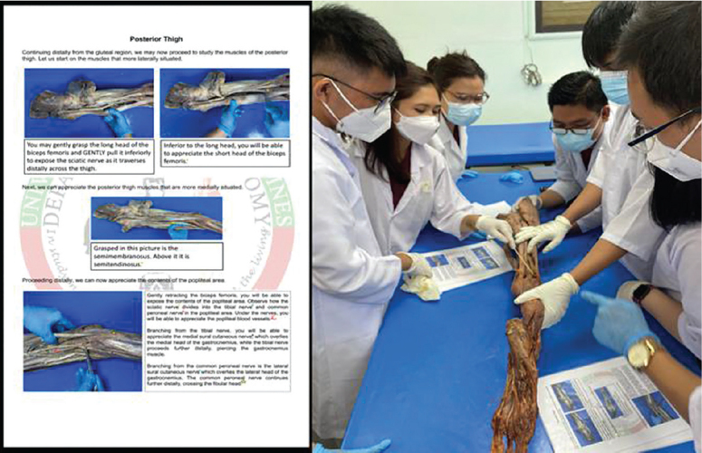 A Case Study on a Novel Teaching Method on Integumentary and Musculoskeletal Anatomy for First Year Medical Students in a National University in the Philippines (University of the Philippines College of Medicine) as a Potential Alternative to Traditional Cadaveric Dissection.