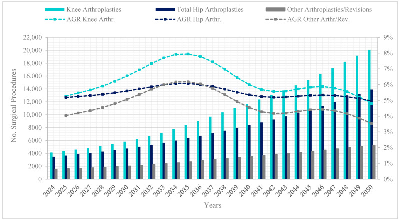 Lower Limb Arthroplasties in Colombia: Projections for 2050 Based on Official Records.