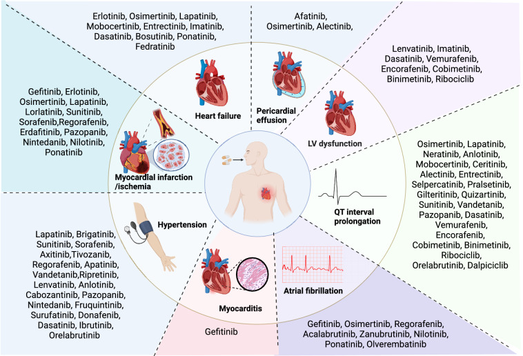 Cardiotoxicity of small-molecule kinase inhibitors in cancer therapy.