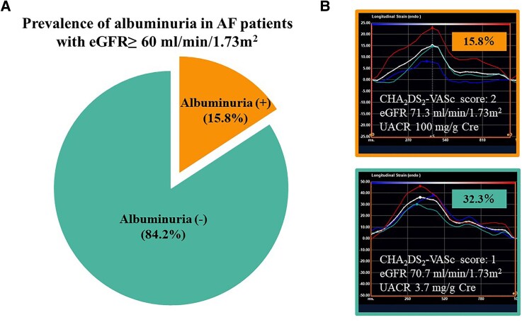 Prevalence of albuminuria and its association with left atrial remodelling in patients with atrial fibrillation.