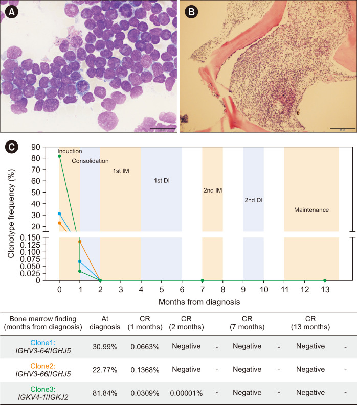 Identification of <i>IGH::DUX4</i> Rearrangements Using RNA-sequencing in a Patient with ALL: A Case Report.
