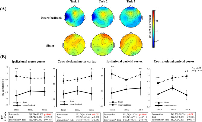 Effect of electroencephalography-based motor imagery neurofeedback on mu suppression during motor attempt in patients with stroke.