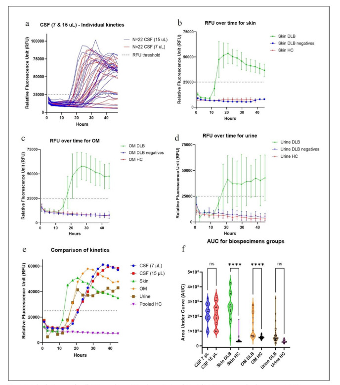Accurate detection of pathologic α-synuclein in CSF, skin, olfactory mucosa, and urine with a uniform seeding amplification assay.
