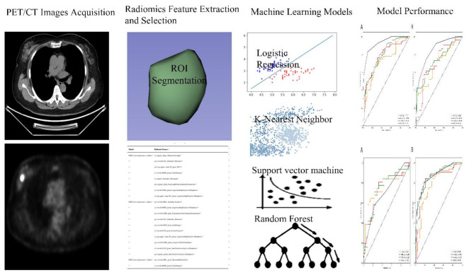 Identification of HER2-over-expression, HER2-low-expression, and HER2-zero-expression statuses in breast cancer based on <sup>18</sup>F-FDG PET/CT radiomics.