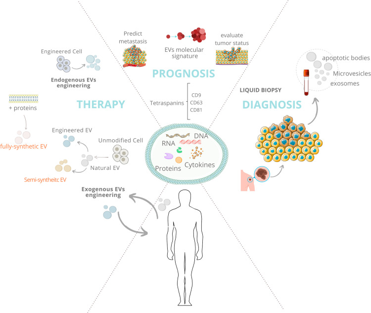 Extracellular vesicles as cancer biomarkers and drug delivery strategies in clinical settings: Advances, perspectives, and challenges.