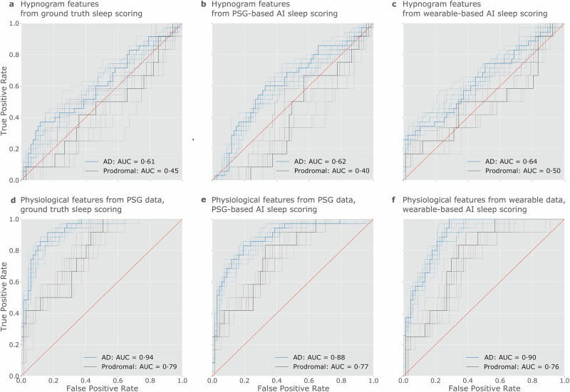Wearable sleep recording augmented by artificial intelligence for Alzheimer's disease screening.