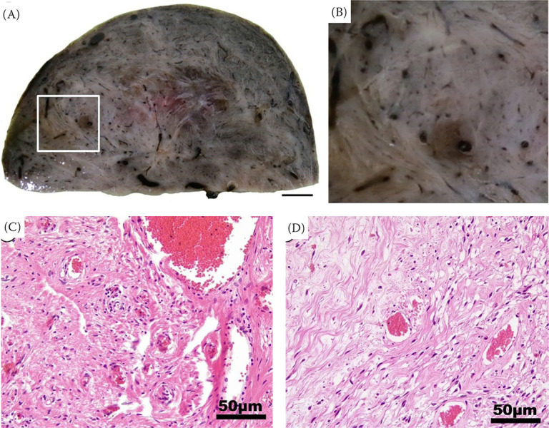 Uterine angiomyofibroblastoma in a domestic cat: A need of precise diagnosis for proper perioperative management.