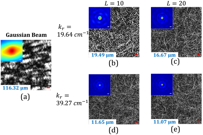 High-resolution quantitative phase imaging via vortex beam speckle illumination.