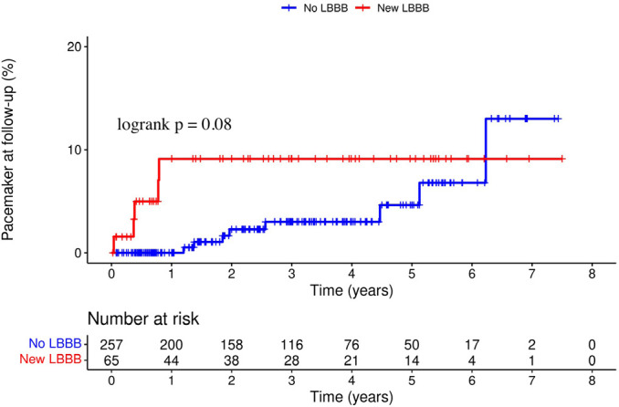 Clinical Impact of New-Onset Left Bundle Branch Block After Transcatheter Aortic Valve Replacement: Data from a Single-Center Retrospective Registry.