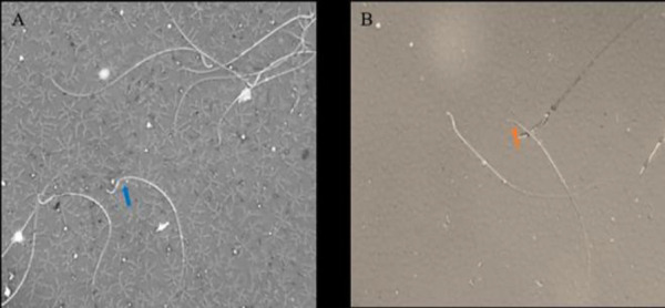 The effects of an Aloe-based polyherbal formulation on fertility parameters in male rats.