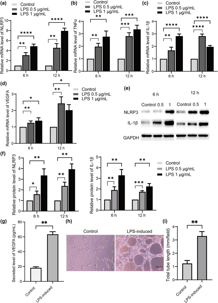 Celastrol suppresses neovascularization in rat aortic vascular endothelial cells stimulated by inflammatory tenocytes via modulating the NLRP3 pathway.