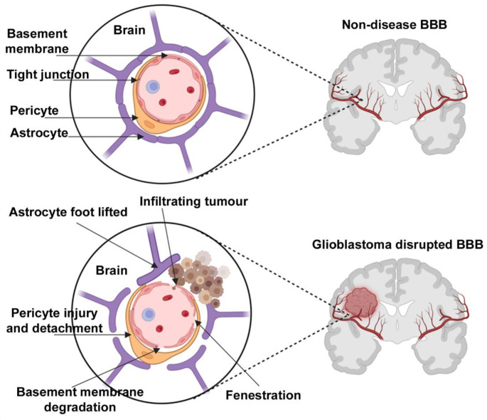 Evolution of Preclinical Models for Glioblastoma Modelling and Drug Screening.