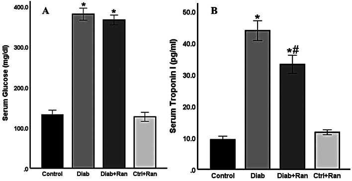 Ranolazine as a therapeutic agent for diabetic cardiomyopathy: reducing endoplasmic reticulum stress and inflammation in type 2 diabetic rat model.