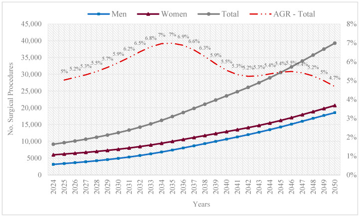 Lower Limb Arthroplasties in Colombia: Projections for 2050 Based on Official Records.