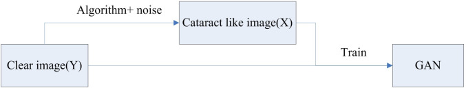 Application of generative adversarial networks in the restoration of blurred optical coherence tomography images caused by optical media opacity in eyes.