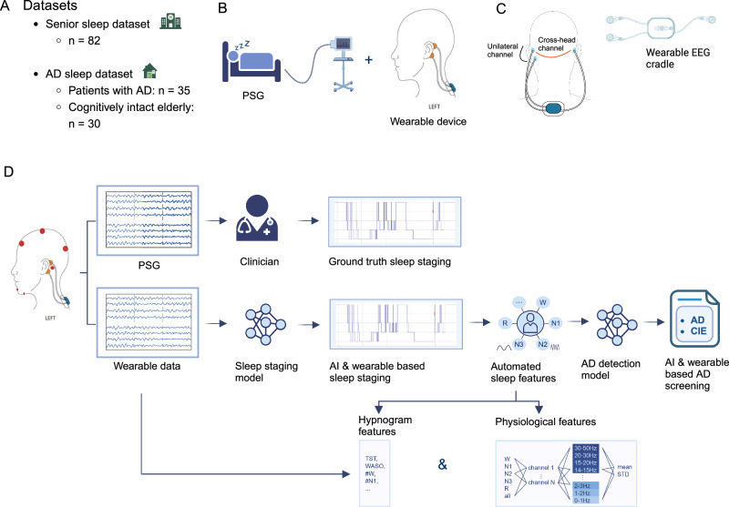 Wearable sleep recording augmented by artificial intelligence for Alzheimer's disease screening.