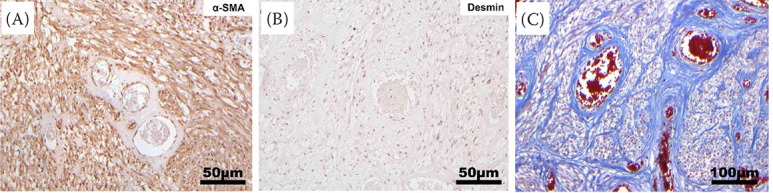 Uterine angiomyofibroblastoma in a domestic cat: A need of precise diagnosis for proper perioperative management.