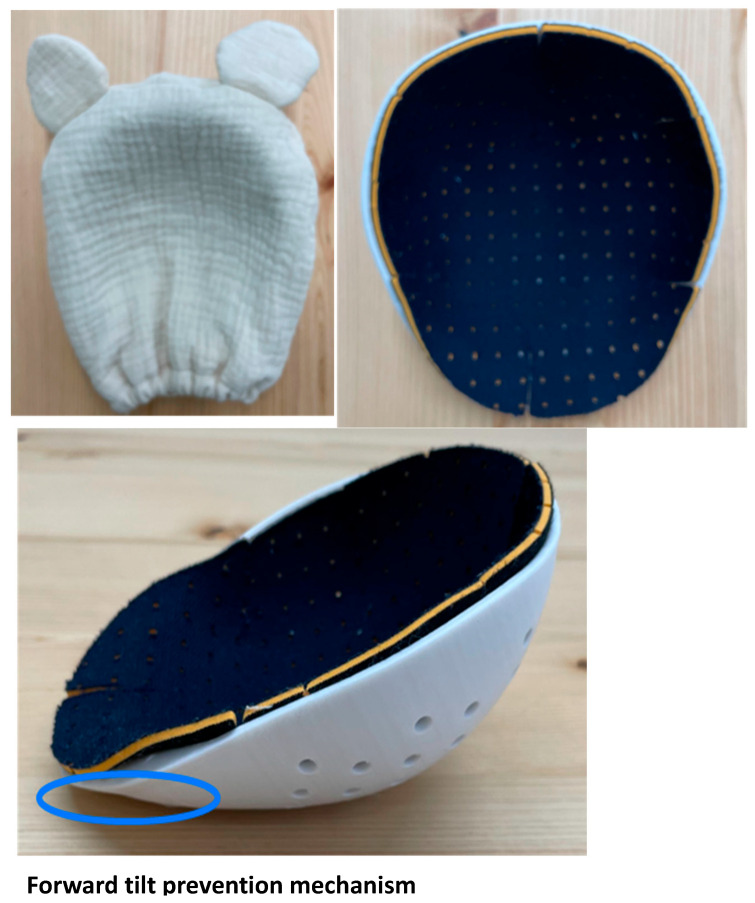 A Novel Prophylactic Device Against Head Deformity to Prevent Severe Positional Plagiocephaly.