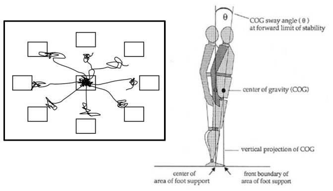Effect of a Six-Month Dance Intervention on Postural Control and Fall-Related Outcomes in Older Adults with Mild Cognitive Impairment: A Randomized Controlled Trial.