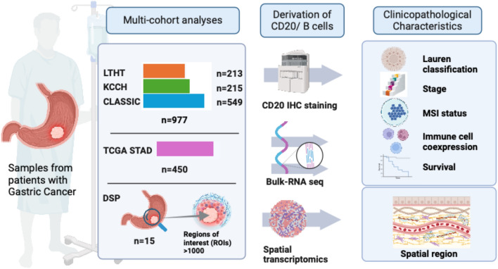 Spatial organization of B lymphocytes and prognosis prediction in patients with gastric cancer.