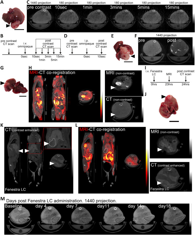A precision image-guided model of stereotactic ablative radiotherapy for hepatocellular carcinoma.