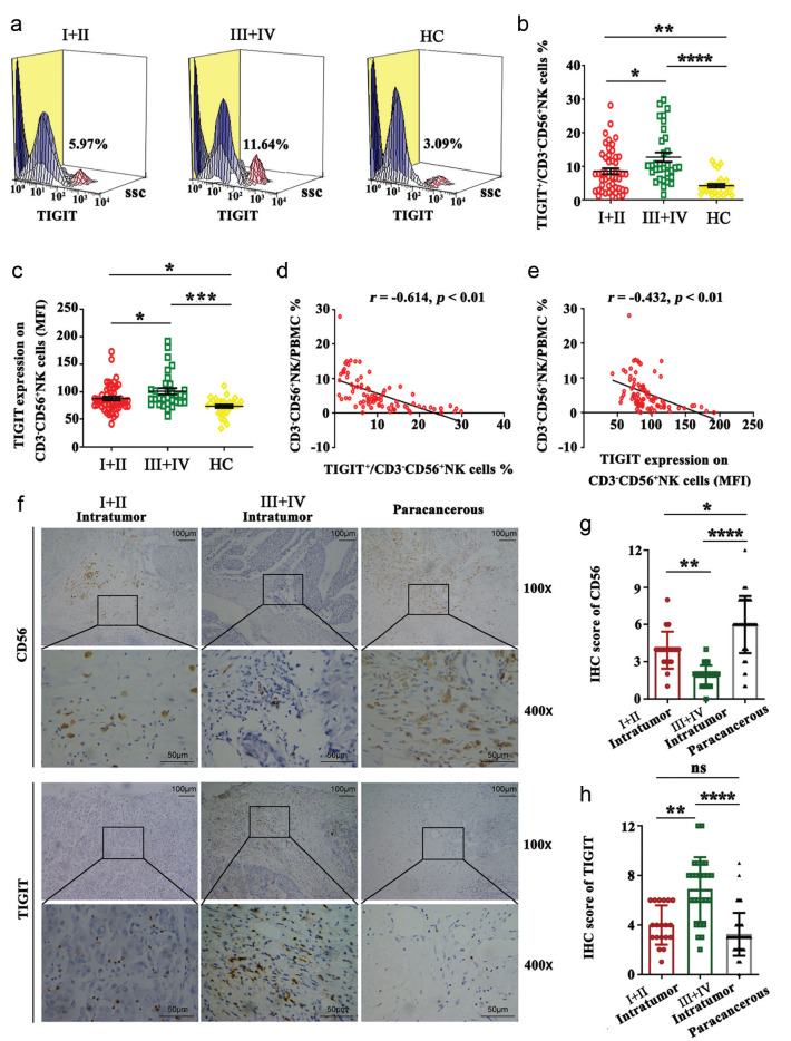 Potential Roles of Serum Exosomal CD155 and its Impact on NK Cell Immunosuppression in Hepatocellular Carcinoma.