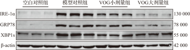 [Vitexin-4 ″-<i>O</i>-glucoside alleviates acetaminophen-induced acute liver injury].