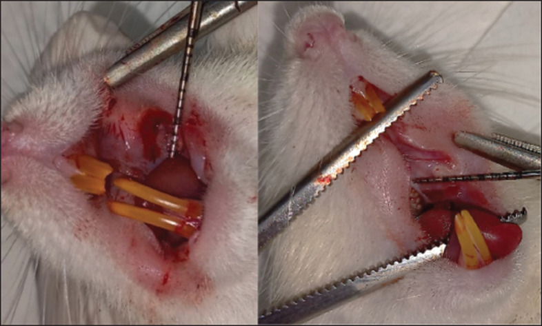 Clinical and histopathological evaluation of 5-fluorouracil-induced oral mucositis in a rat model.