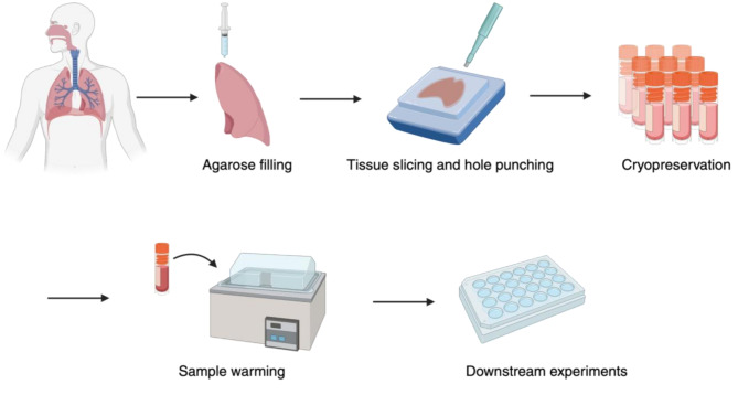 Cryopreservation of human lung tissue for 3D ex vivo analysis.