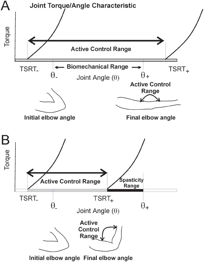 Clinical Relevance of the Tonic Stretch Reflex Threshold and μ as Measures of Upper Limb Spasticity and Motor Impairment After Stroke.