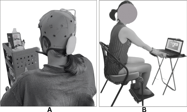 Tele-rehabilitation using transcranial direct current stimulation combined with exercise in people with spinal cord injury: a randomized controlled trial.