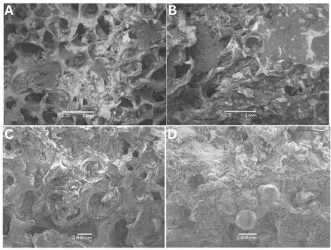 Biofilm-Induced Bone Degradation in Osteomyelitis: <i>Insights from a comprehensive ex vivo pathogen interaction study</i>.