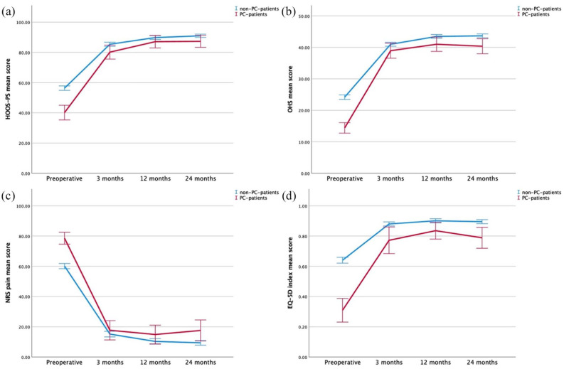 The role of pain catastrophising on subjective function and pain following total hip arthroplasty: a prospective comparative study of 531 patients with 2-year follow-up.