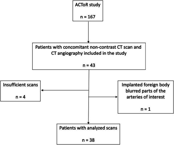Assessment of aortic and iliac artery calcification using CT-angiography in kidney transplant candidates.