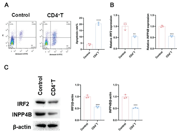 The IRF2-INPP4B Pathway Aggravates Acute Myeloid Leukemia