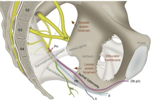 Optimizing Paediatric Hypospadias Surgical Repair: Pudendal Nerve Block Versus Caudal Block for Superior Analgesia.