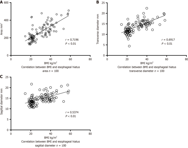 Association of esophageal hiatus size with reflux esophagitis and type I hiatal hernia in patients with obesity.