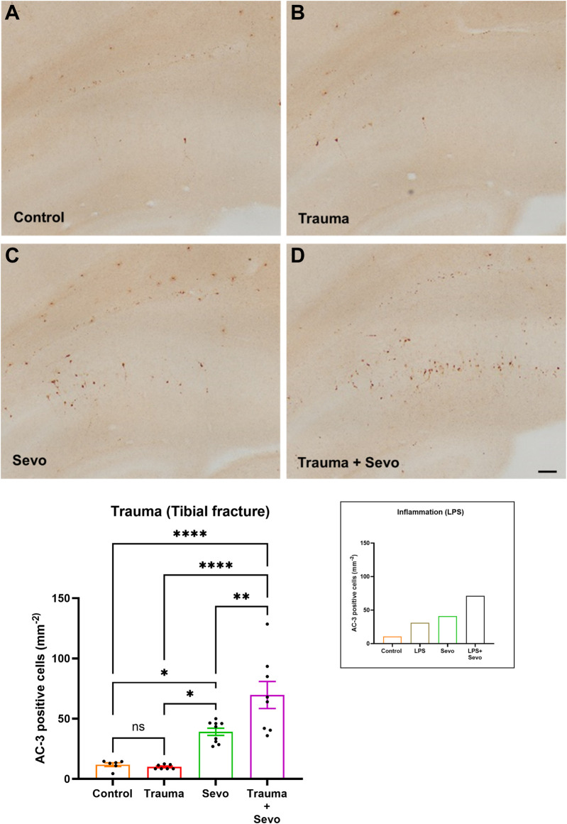 Anesthesia-induced developmental neurotoxicity in the setting of systemic inflammation: the role of microglia.