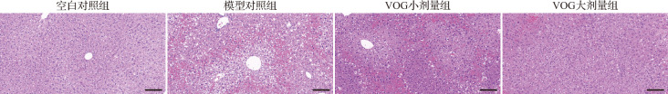 [Vitexin-4 ″-<i>O</i>-glucoside alleviates acetaminophen-induced acute liver injury].