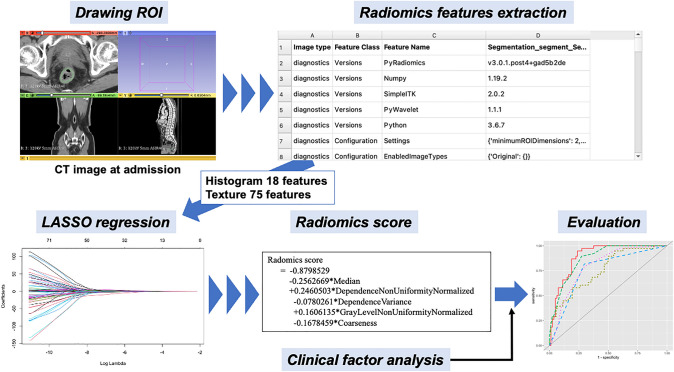 Radiomics prediction of surgery in ulcerative colitis refractory to medical treatment.