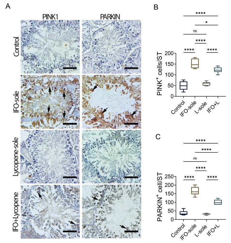 Protective Effect of Lycopene on Ifosfamide-Induced Mitophagy through <i>Pink, Parkin,</i> and <i>LC3-I/II</i> Pathway in Testicular Tissue.