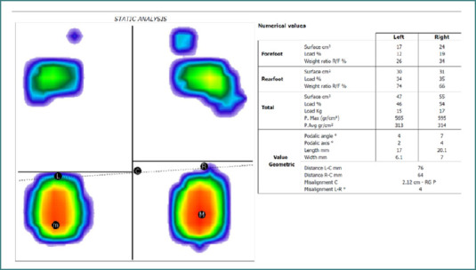 Evaluating plantar correction strategies in pediatric growing pains: a postural and pain analysis in 647 children.