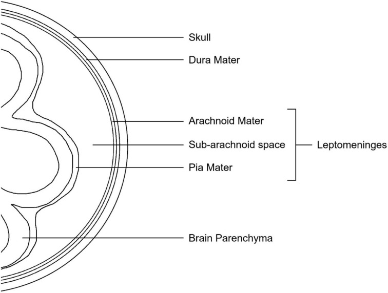 Leptomeningeal carcinomatosis in gastric cancer: A Review.