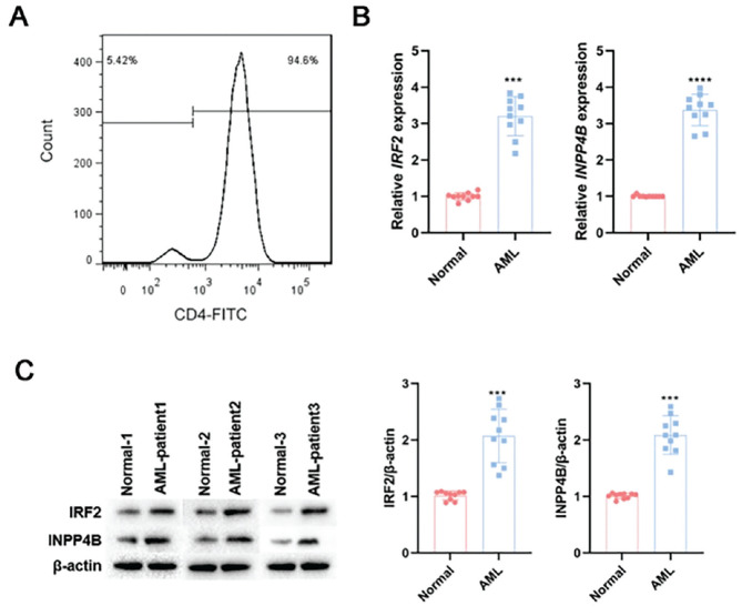 The IRF2-INPP4B Pathway Aggravates Acute Myeloid Leukemia