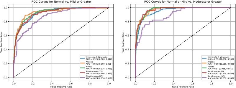A deep learning model for classifying left ventricular enlargement for both transthoracic echocardiograms and handheld cardiac ultrasound.